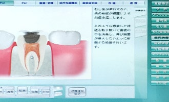 治療内容のご説明