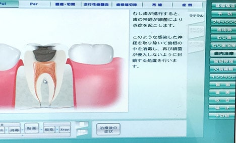 治療内容のご説明